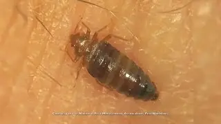 Here's Why Bed Bugs Are So Hard To Get Rid Of