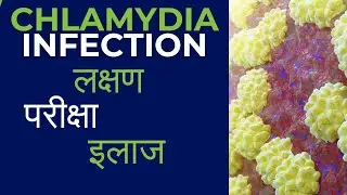 Chlamydia treatment in Hindi | Chlamydia kya hota hai | chlamydia infection symptoms, diagnosis