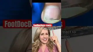 How NOT to remove an ingrown toenail