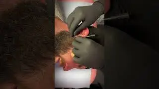 Surface Tragus Piercing ⚠️