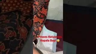 Masyallah persalinan tenang dengan di tiup aja Lahir😇😚 
