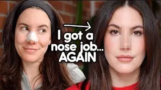 I Got (Another) Nose Job 👀 | My Revision Rhinoplasty Journey & Recovery Vlog