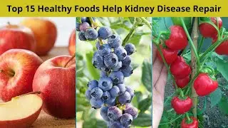 Top 15 Healthy Foods Help Kidney Disease Repair