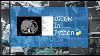4.Write dicom header to csv file
