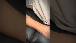 Dermal Piercing 💎 Full process 