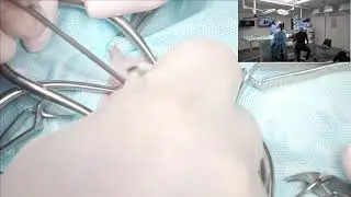 Новообразование буллы у кошки