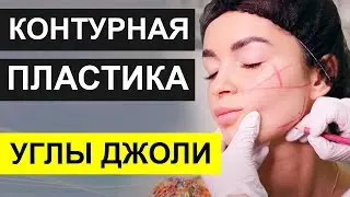 КАК ВИЗУАЛЬНО СУЗИТЬ ЛИЦО - Контурная пластика УГЛЫ ДЖОЛИ