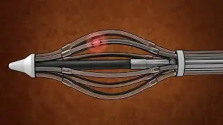 Expedited Breast Cancer Treatment - Brachytherapy - Mayo Clinic