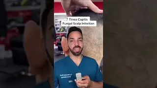 Barbershop NIGHTMARE | A Fungus Among Us 