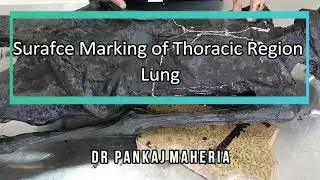 Surface Anatomy of Lung | Viva Voce of Anatomy