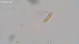 Rainwater Under Microscope