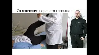 Отключение нервного корешка