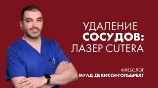 Удаление сосудов: волшебная Cutera | Флеболог
