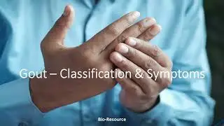Purine Catabolism Disorder: Hyperuricemia : Gout - Classification, Symptoms