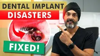 Fixed: Dental Implants Abroad