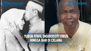 Kondisi Kiwil Melemah, Tubuh Digerogoti Virus hingga BAB di Celana