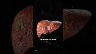 Как лишний жир влияет на наше тело. Наглядный пример