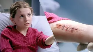 A young girl stapled her wound shut with a stapler