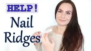 Vertical Nail Ridges, Breaking + Cracking | Causes & Cures | Dos and Don'ts