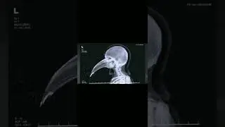 Кто такой SCP-049?