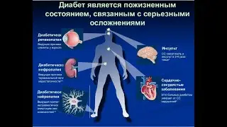 Сахарный диабет   СВО    ВВК   увольнение  voenset ru   1