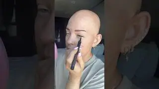 How people react to me being bald