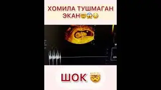 ХОМИЛА ТУШМАГАН ЭКАН😳🤯 телеграм ракамларимиз: 974470847, 950014004 инстаграм: @uzi001tashkent