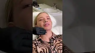 Обман КОСМЕТОЛОГА 😳💉