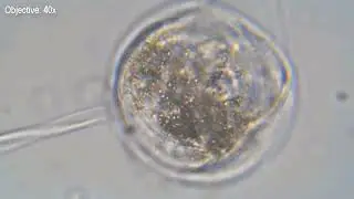 Pond Water Observation 10.04.2024