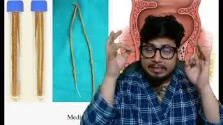 Kshar sutra kya hota hai | Kshar sutra treatment in ayurveda
