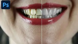 How to Whiten Teeth In Photoshop