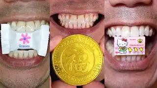 Can You Guess How Many Candies I Chewed in This Video? Doctor Tristan Peh ASMR
