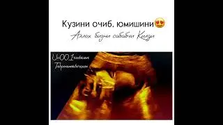 МАЛУМОТ УЧУН ФАКАТ ТЕЛЕГРАМДАН ЁЗИНГ: +998950014004 #Узи #беременность #гинекология #Хомиладорлик