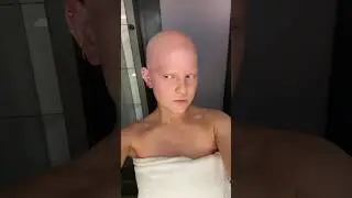 BALD OR BLONDE… you will never know