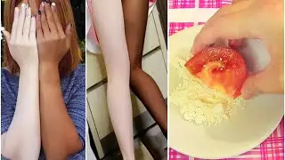 Skin Whitening Tomato Facial. Get Fair, Glowing, Spotless Skin Permanently