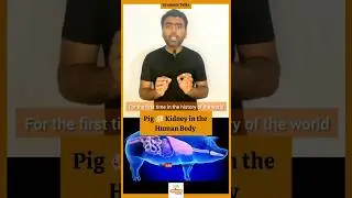 First Pig Kidney Transplant in Humans | Kidney Transplant |