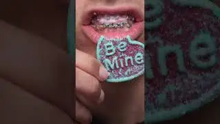 Are teeth supposed to move like this?
