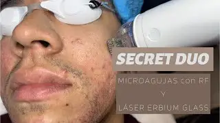 Tratamiento Secret Duo