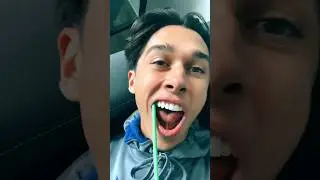 Never go to a Gen Z dentist… ​⁠