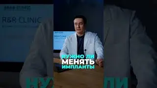 Нужно ли менять импланты?