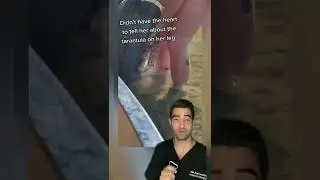 Spider Bite