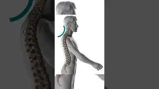 ЧТО ДЕЛАТЬ ЕСЛИ ЗАЩЕМИЛ ШЕЙНЫЕ НЕРВЫ?