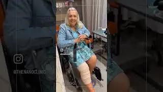 Susan Feeling Great and Walking with Stability Right after Her Nano Procedure