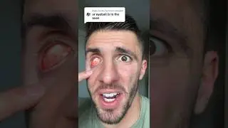 MY EYEBALL MELTED 😮
