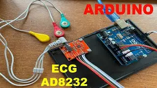 ECG AD8232 ARDUINO
