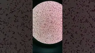 Staphylococcus under the microscope 