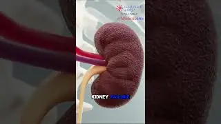 Strep Throat  🤒 Sore Throat ⚕️3D Medical Animation
