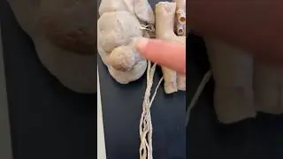 Check out this real male anatomy dissection! Highlighting male sexual organs 🍆. #anatomy