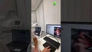 Протезирование зубов на имплантатах в Сочи