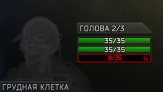 Тарков, когда на кону 20к (challenge vs. nesp)